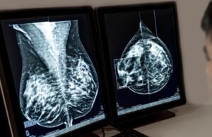 Novartis recibe aprobación de la Comisión Europea para Kisqali en cáncer de mama HR+/HER2- con alto riesgo de recaída