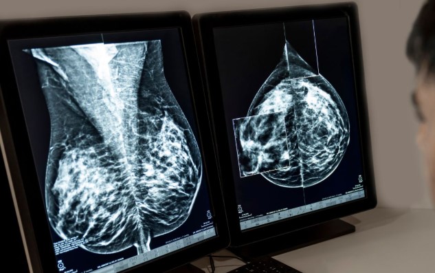 Novartis recibe aprobación de la Comisión Europea para Kisqali en cáncer de mama HR+/HER2- con alto riesgo de recaída