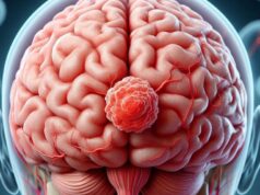 Astuce Spain denuncia desigualdad en acceso a ensayos clínicos de tumores cerebrales