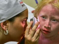 Isdin atiende a más de cien pacientes con albinismo en su expedición a Panamá