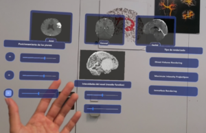 La Generalitat Valenciana apoya el avance en neurocirugía con una plataforma de realidad aumentada