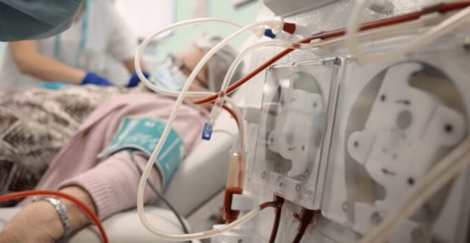 La enfermedad renal crónica se consolida como reto sanitario en España