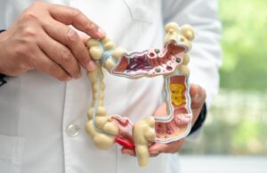 Expertos subrayan la importancia del cribado en el cáncer de colon