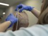 Hospital público 12 de Octubre investiga TTFields y pembrolizumab en ensayo clínico para glioblastoma recién diagnosticado