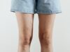 Varices y mala circulación: por qué no debemos normalizar las piernas hinchadas