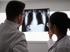 Pacientes y especialistas reclaman más conocimiento sobre la fibrosis pulmonar