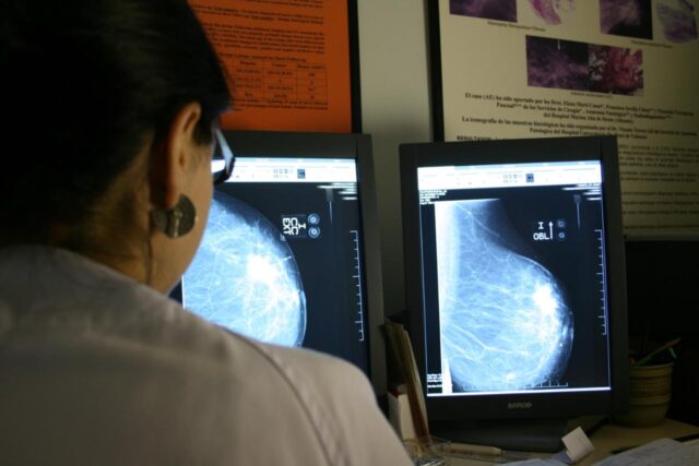 Mas_de_311000_mujeres_examinadas_en_la_Comunitat_Valenciana_gracias_al_programa_de_cribado_de_cancer_de_mama.jpg